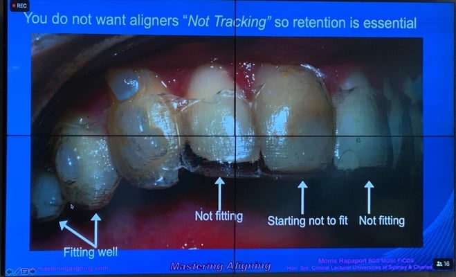 mastering aligning fit picture