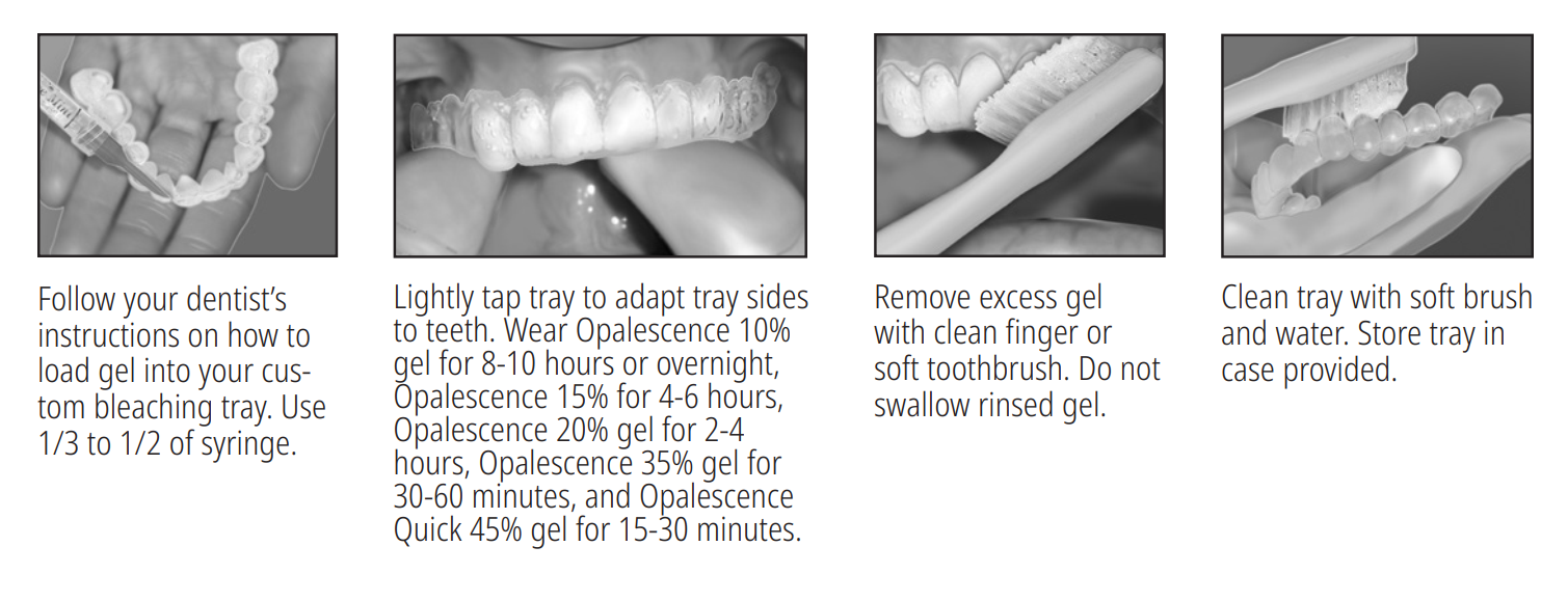 opalesence pf whitening instructions